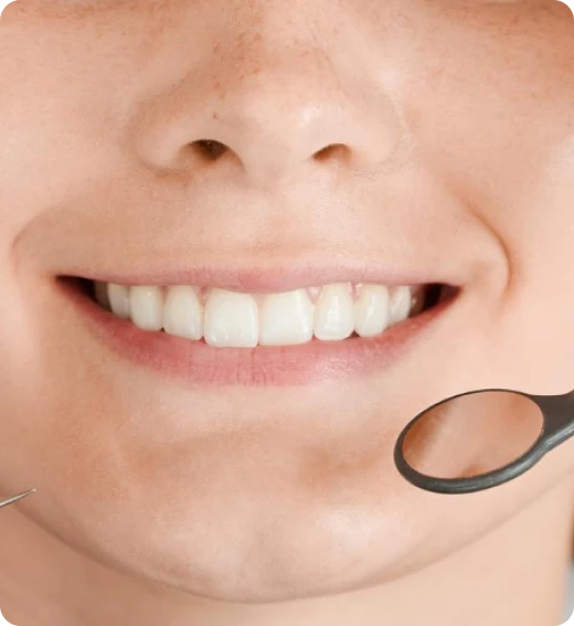 Resultado alinhadores invisíveis